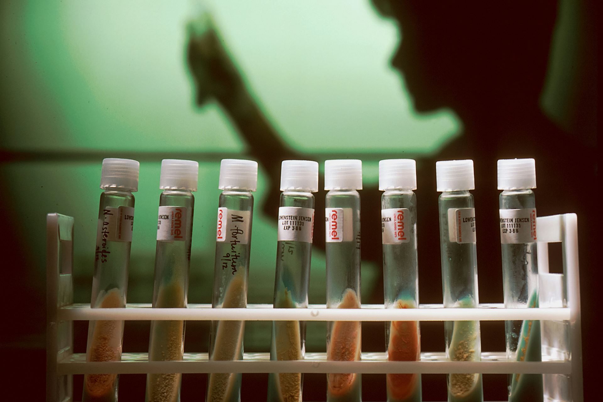 test tubes in a rack and a the shadow of a lab technician in the background